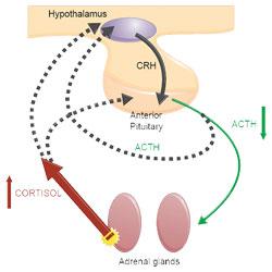 Overactive adrenaline glands Adrenal dependent hypercortisolism