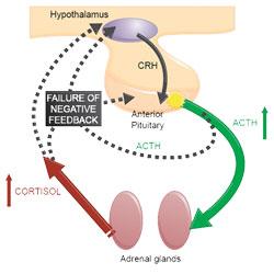 Pituitary dependent hypercortisolism Adrenal cortex diagram